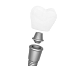 Straumann SLA