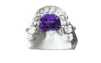 Несъемные ортодонтические аппараты в Нижнем Новгороде ARTDENT