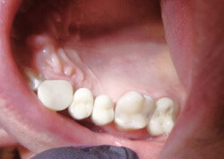 После лечения