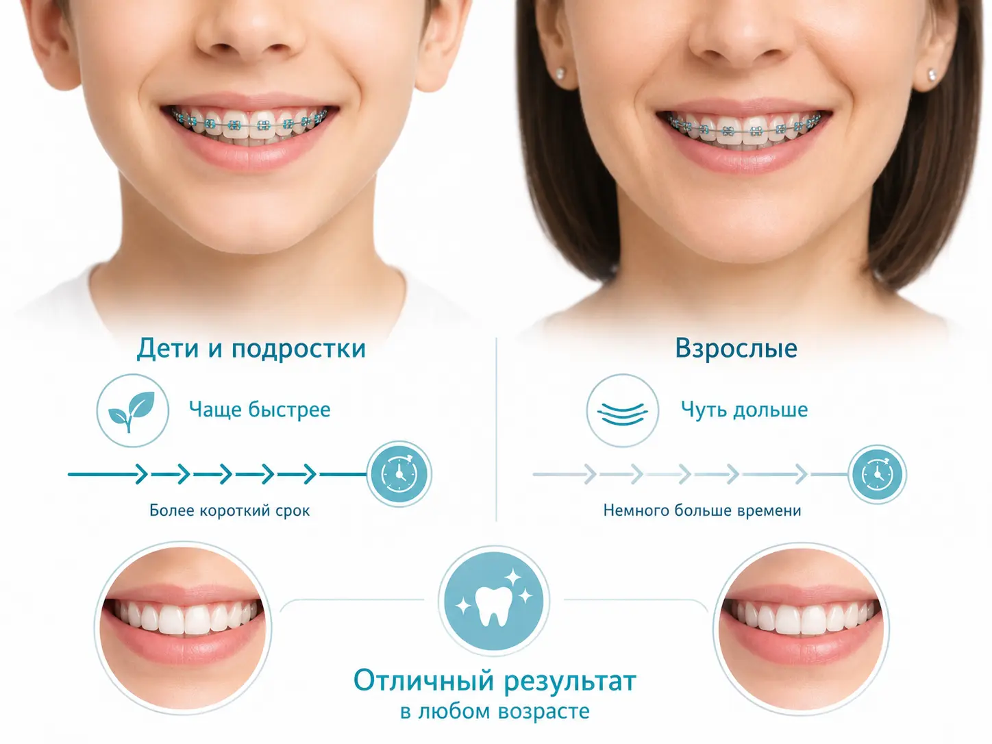 Эстетические керамические брекеты на зубах