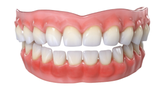 Лечение заболеваний слизистой оболочки полости рта в Нижнем Новгороде