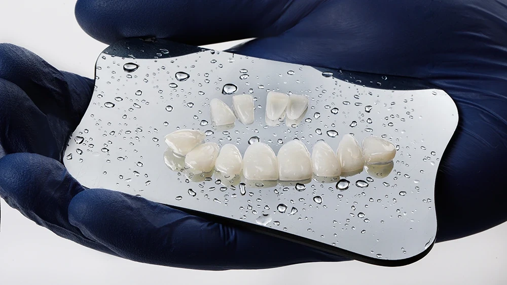 Готовые к установке композитные виниры