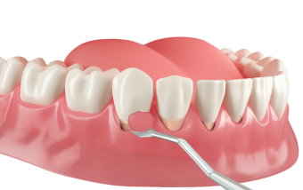 Подготовка к ортопедическому лечению в Нижнем Новгороде