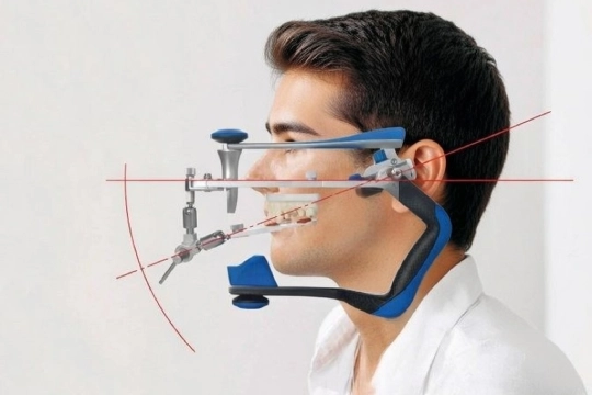 Артикулятор на пациенте