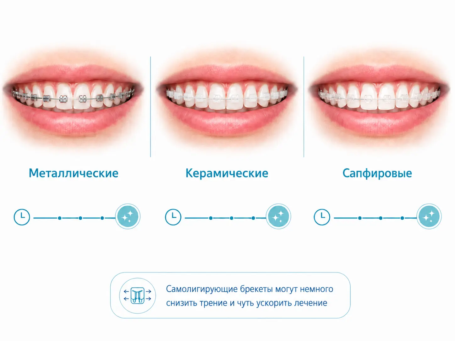 Лингвальные невидимые брекеты