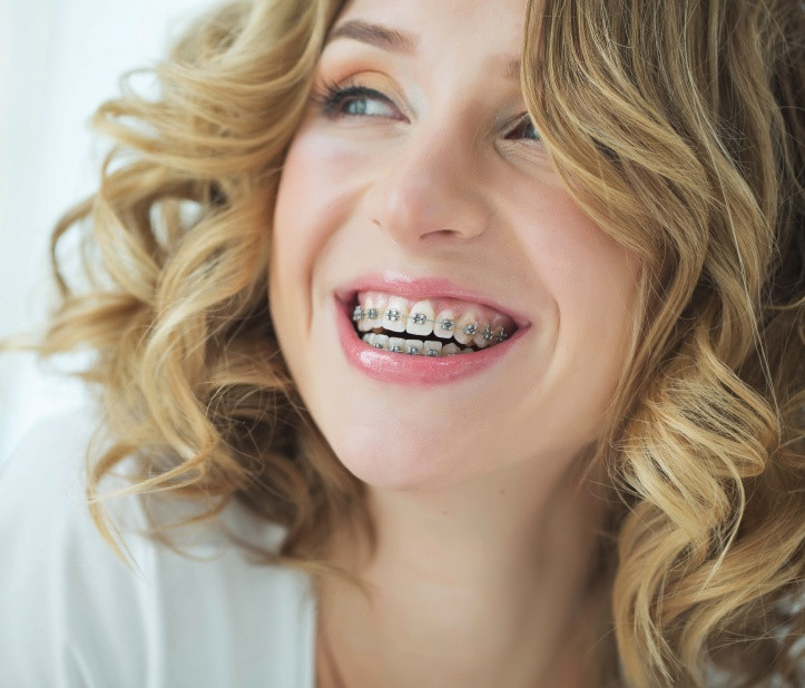 Брекеты DAMON