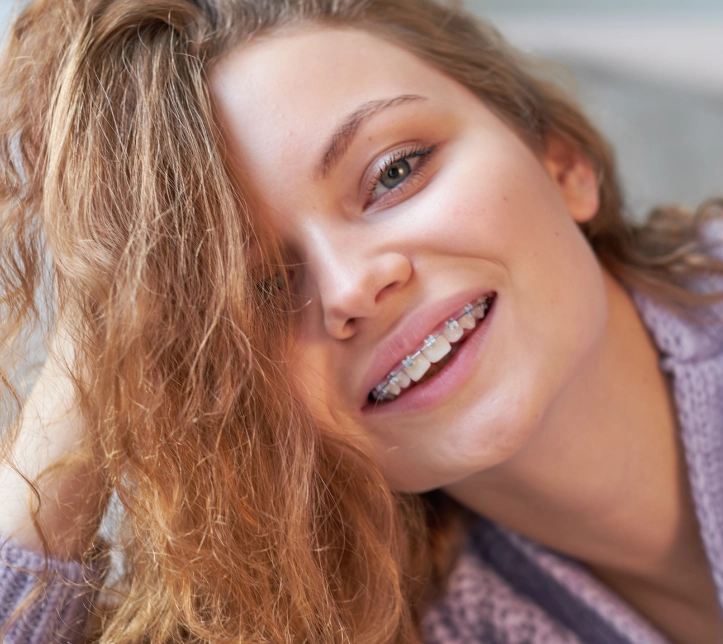 Брекеты MINI DIAMOND Biomim