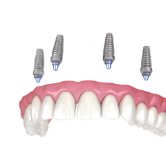Услуги стоматологической клиники в НН